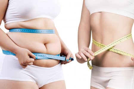Женщина похудела почти на 70 килограммов благодаря диете из 1985 года