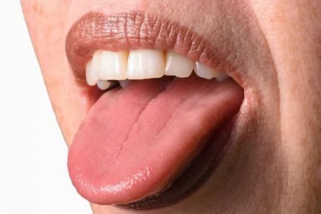 На какое опасное заболевание может указывать покрасневший и опухший язык