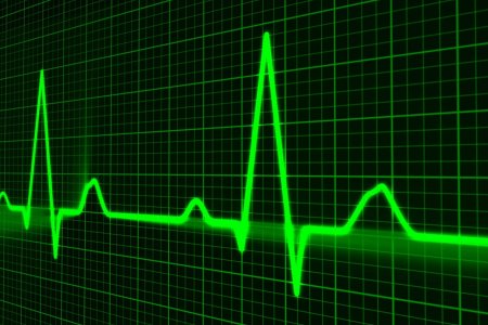 Безболезненный инфаркт: как распознать опасное состояние