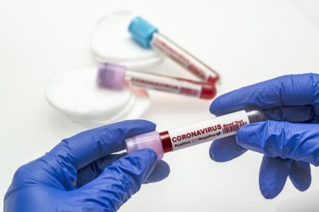 Доказана связь коронавируса с группой крови