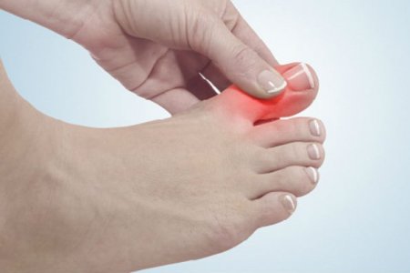 На какое серьезное заболевание указывает внезапная боль в пальце ноги