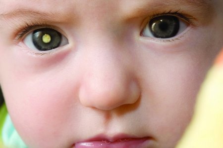 Первые признаки распространённого вида рака у маленьких детей